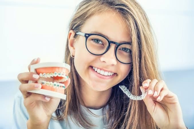 Teeth Braces & Teeth Aligners