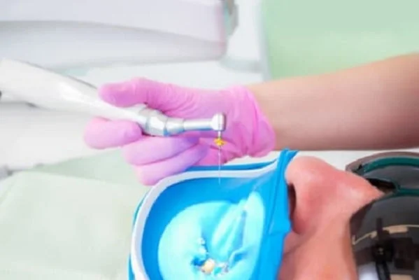 #1 Root Canal Specialist | Trusted Endodontist in Lake Town